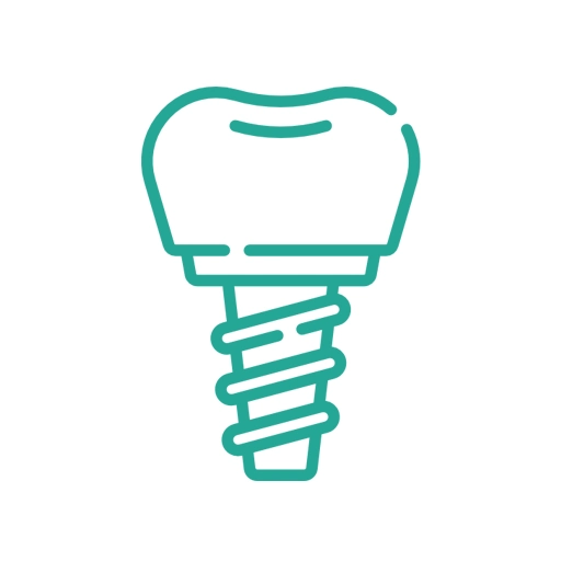 Implantes Dentários